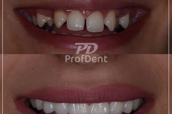 Özel ProfDent Van Ağız ve Diş Sağlığı Polikliniği - Resim 12