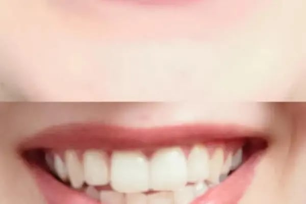 Özel ProfDent Van Ağız ve Diş Sağlığı Polikliniği - Resim 9
