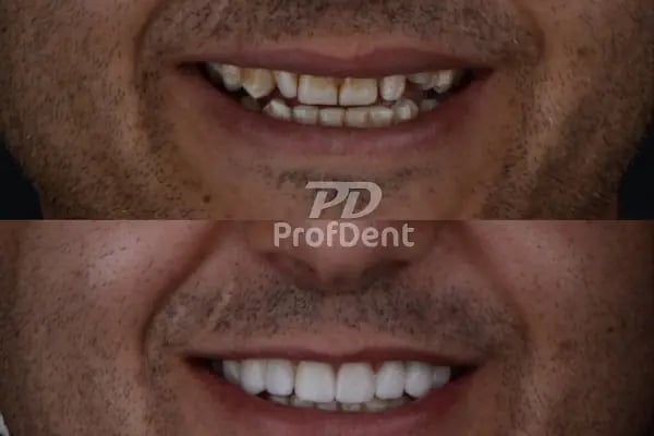 Özel ProfDent Van Ağız ve Diş Sağlığı Polikliniği - Resim 13