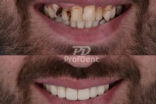 Özel ProfDent Van Ağız ve Diş Sağlığı Polikliniği - Resim 10