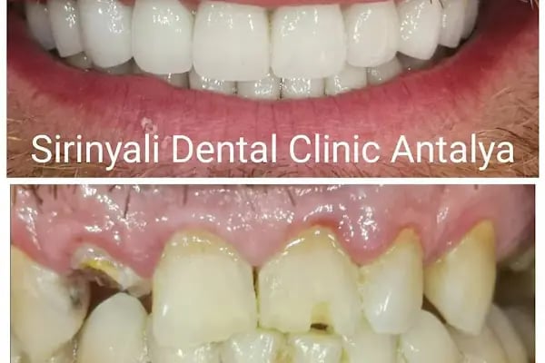 Özel Şirinyalı Ağız ve Diş Sağlığı Polikliniği - Resim 13