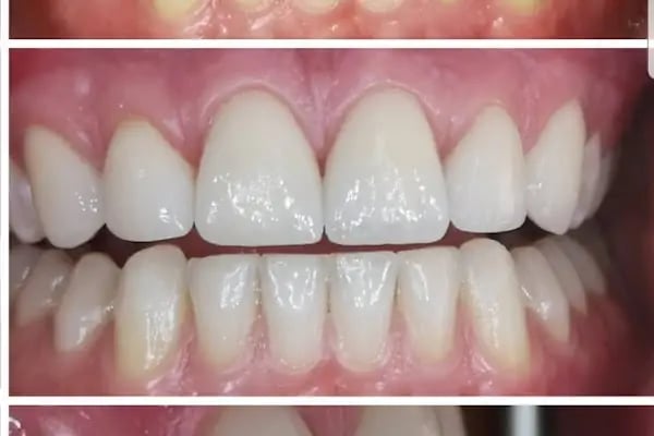 Özel Şirinyalı Ağız ve Diş Sağlığı Polikliniği - Resim 11