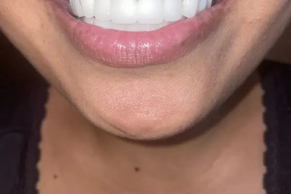 Özel Şirinyalı Ağız ve Diş Sağlığı Polikliniği - Resim 9