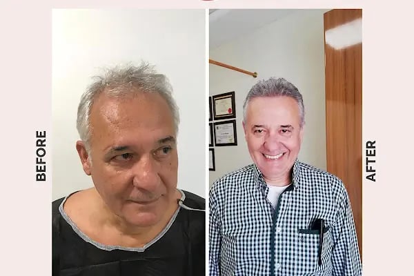 Ekol Saç Ekim Merkezi - Resim 16