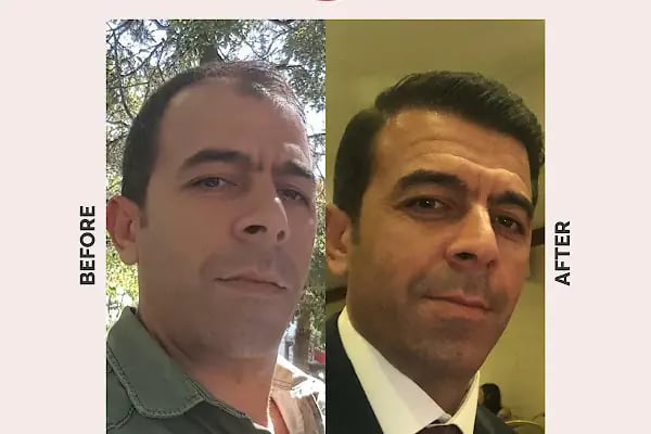 Ekol Saç Ekim Merkezi - Resim 18
