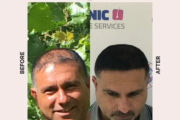 Ekol Saç Ekim Merkezi - Resim 13