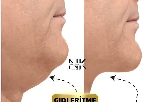 Novaklin Estetik ve Güzellik - Resim 19