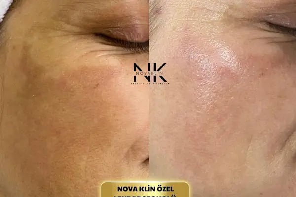 Novaklin Estetik ve Güzellik - Resim 8