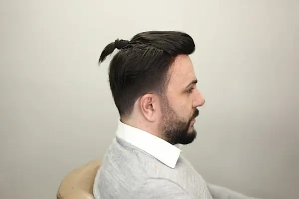 Gold Hair İstanbul - Protez Saç ve Gerçek Saç Merkezi | Real Hair Replacement Center - Resim 14