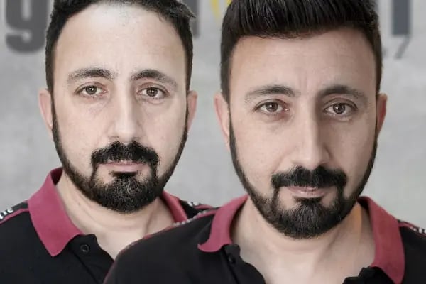 Gold Hair İstanbul - Protez Saç ve Gerçek Saç Merkezi | Real Hair Replacement Center - Resim 20