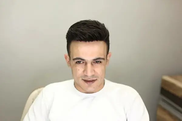 Gold Hair İstanbul - Protez Saç ve Gerçek Saç Merkezi | Real Hair Replacement Center - Resim 6