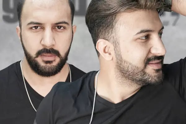 Gold Hair İstanbul - Protez Saç ve Gerçek Saç Merkezi | Real Hair Replacement Center - Resim 15