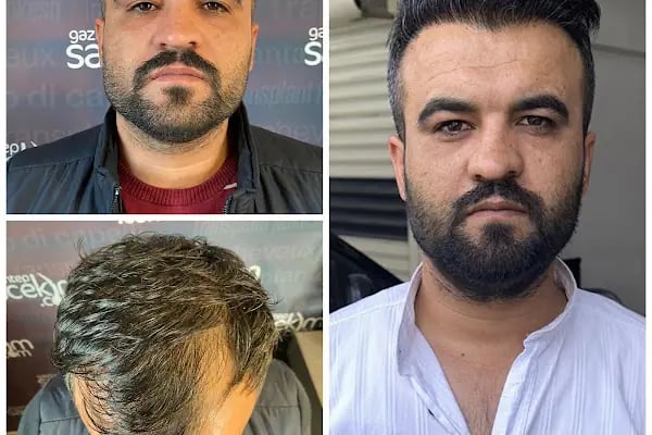 Serap Lazer Epilasyon &amp; Güzellik Salonu Birecik - Resim 14