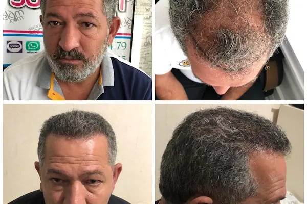 Serap Lazer Epilasyon &amp; Güzellik Salonu Birecik - Resim 19