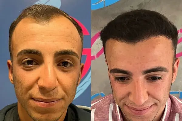 Serap Lazer Epilasyon &amp; Güzellik Salonu Birecik - Resim 20