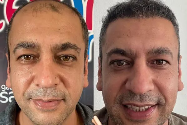Serap Lazer Epilasyon &amp; Güzellik Salonu Birecik - Resim 11
