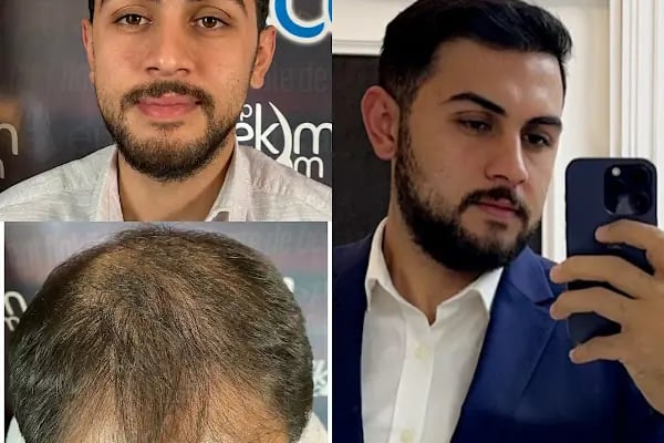 Serap Lazer Epilasyon &amp; Güzellik Salonu Birecik - Resim 10