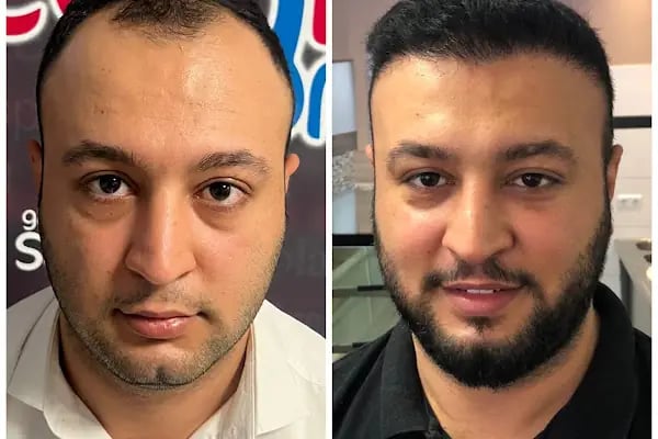 Serap Lazer Epilasyon &amp; Güzellik Salonu Birecik - Resim 6