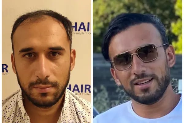 Serap Lazer Epilasyon &amp; Güzellik Salonu Birecik - Resim 7