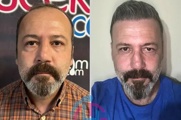 Serap Lazer Epilasyon &amp; Güzellik Salonu Birecik - Resim 16