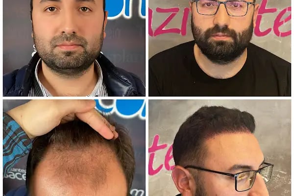 Serap Lazer Epilasyon &amp; Güzellik Salonu Birecik - Resim 18