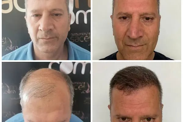Serap Lazer Epilasyon &amp; Güzellik Salonu Birecik - Resim 15