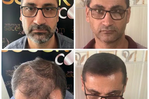Serap Lazer Epilasyon &amp; Güzellik Salonu Birecik - Resim 13