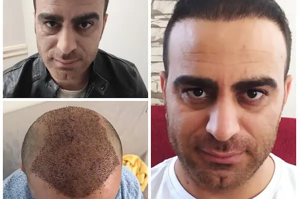 Serap Lazer Epilasyon &amp; Güzellik Salonu Birecik - Resim 1