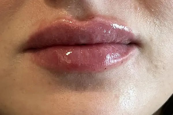 Prof. Dr. Ö. Taşkın Yücel kbb uzmanı estetik ve fonksiyonel burun ameliyatları ve Yüz estetiği i - Resim 10