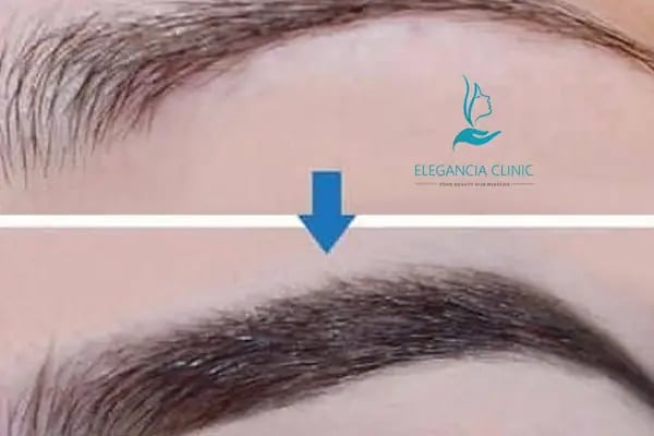 Elegancia Clinic - Resim 10