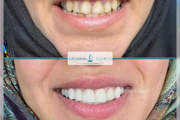 Elegancia Clinic - Resim 18