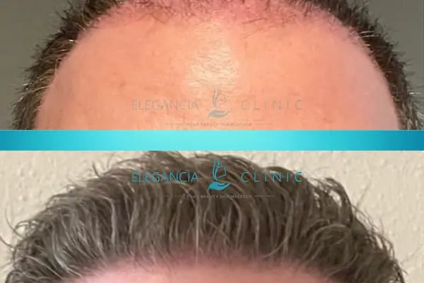 Elegancia Clinic - Resim 6
