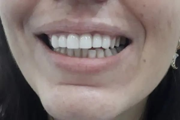 Doç. Dr. Tennure Yazanel Diş Kliniği - Resim 6