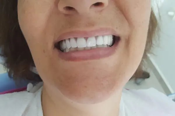 Doç. Dr. Tennure Yazanel Diş Kliniği - Resim 8