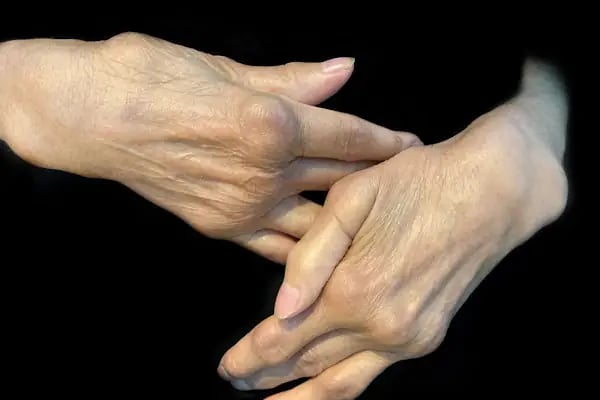 Prof Dr Süleyman Özbek Romatoloji ve İç Hastalıkları Uzmanı - Resim 12