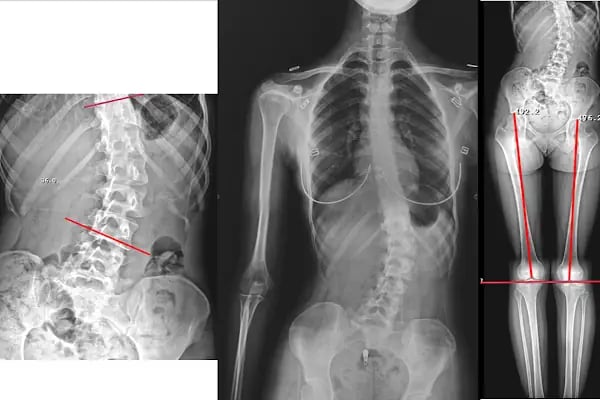 Doç. Dr. Hanifi ÜÇPUNAR - Medical Park Bursa Hastanesi - Ortopedi ve Omurga Cerrahisi - Resim 3