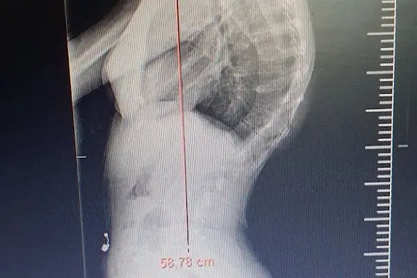 Doç. Dr. Hanifi ÜÇPUNAR - Medical Park Bursa Hastanesi - Ortopedi ve Omurga Cerrahisi - Resim 14