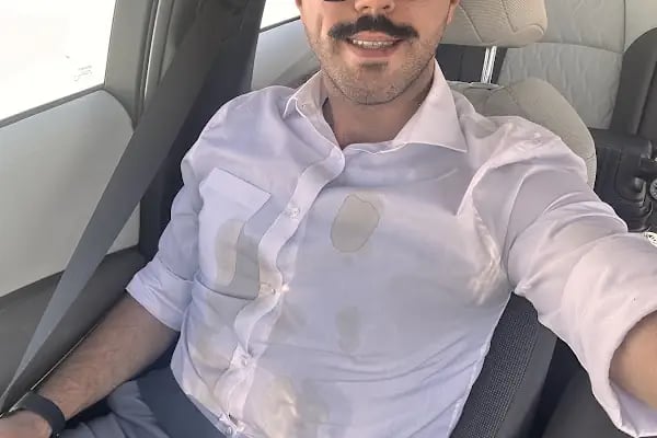 En kuru temizleme - Resim 3