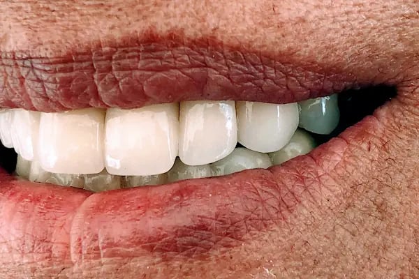 Dentist Fatma İldem Diş Hekimi - Resim 14