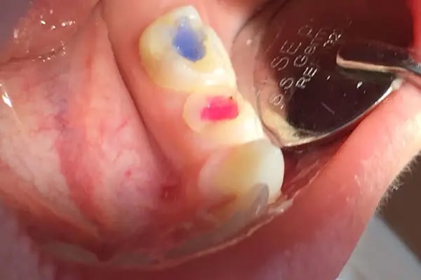 Dentist Fatma İldem Diş Hekimi - Resim 17