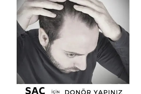 S Clinic Diyarbakır - Saç Çoğaltma, Saç Bakım ve Güzellik Merkezi - Resim 12
