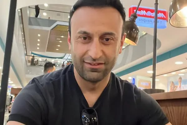 Saç Ekimi - Hair Transplant - Resim 14