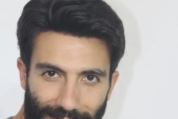 saç protez merkezi - Resim 17
