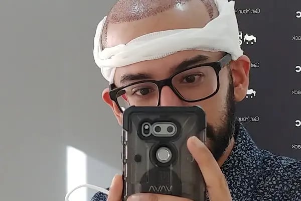MC Hair Center Saç Ekim &amp; Estetik Merkezi - Resim 18