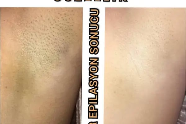 AHSEN VİP GÜZELLİK SALONU - Resim 6