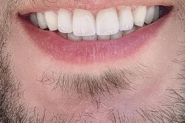Dentpoint Ağız Ve Diş Sağlığı Polikliniği - Resim 2