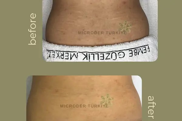 MICRODER TÜRKİYE ® Zerin Turhan - Resim 13