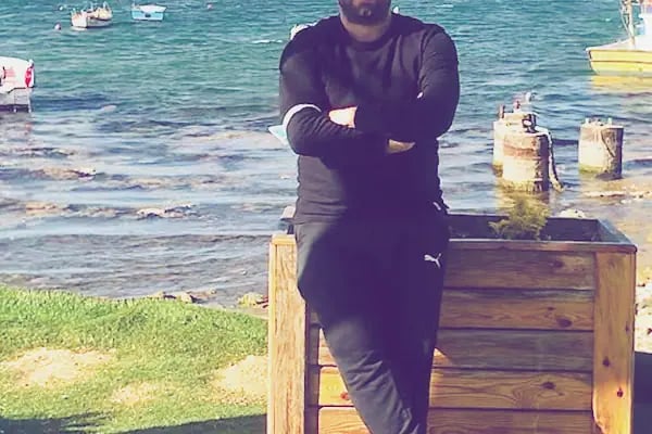 AVRUPA SAÇ EKİMİ - AVRUPA HAİR TRANSPLANT.|Greffe de Cheveux Turquie | Trasplante Capilar Turquia | Пересадка Волос в Турции - Resim 13
