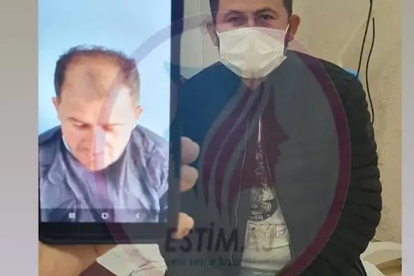 A Plus Hair Transplant &amp; Hair Clinic Saç Ekim Merkezi - Resim 17