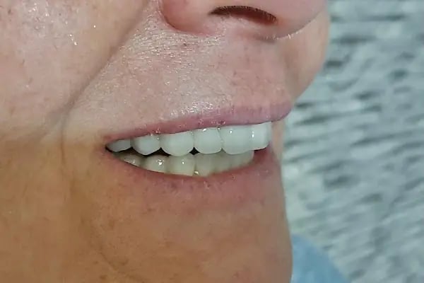 Özel Güneşevler Diş Polikliniği - Resim 9